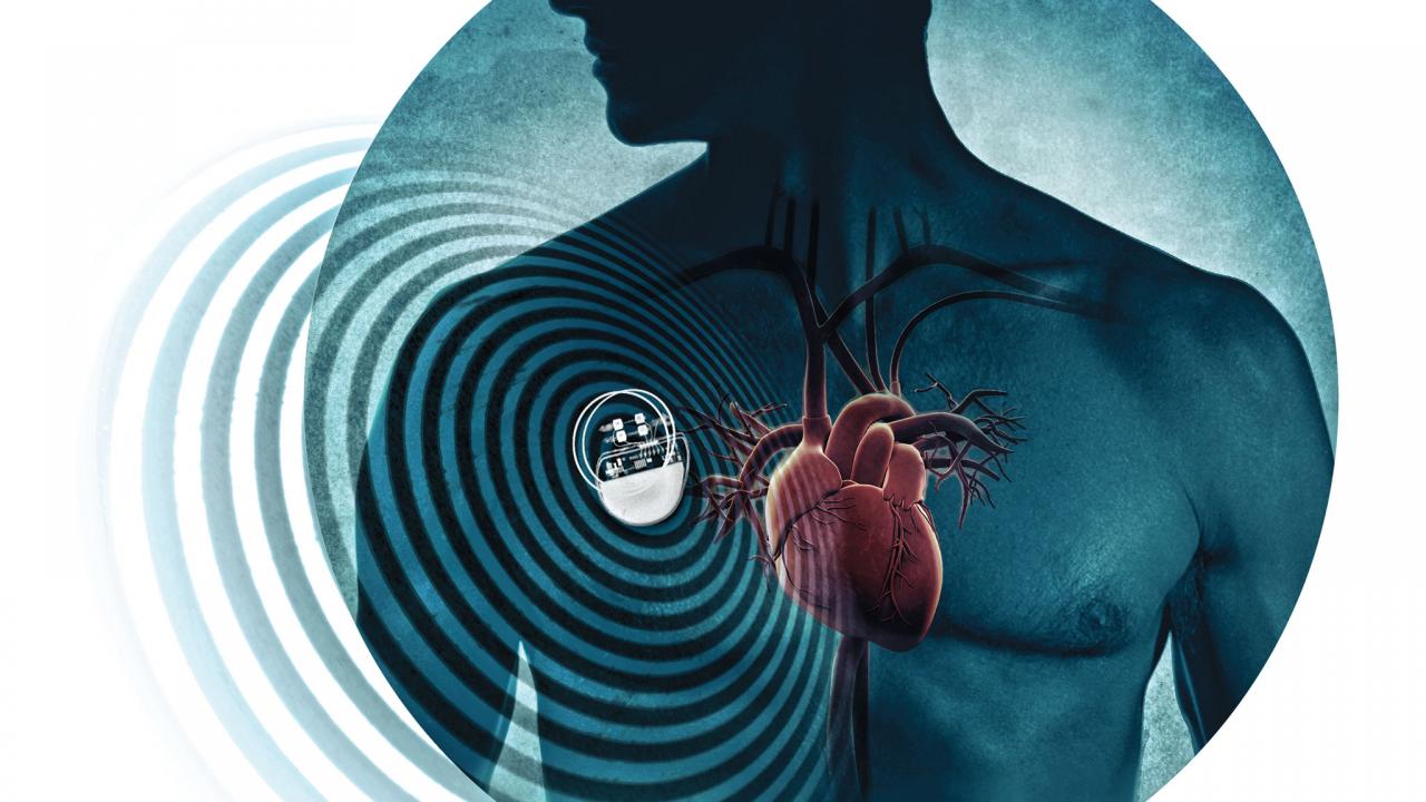 Internet delle Cose,50 mila pacemaker a rischio attacchi informatici negli USA